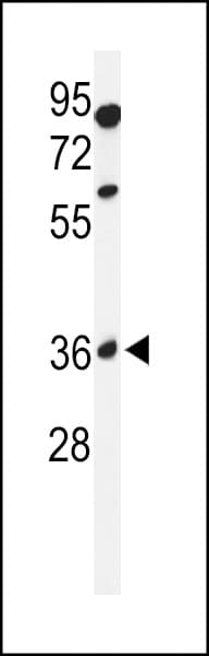 GLT8D2 Antibody (aa14-42)
