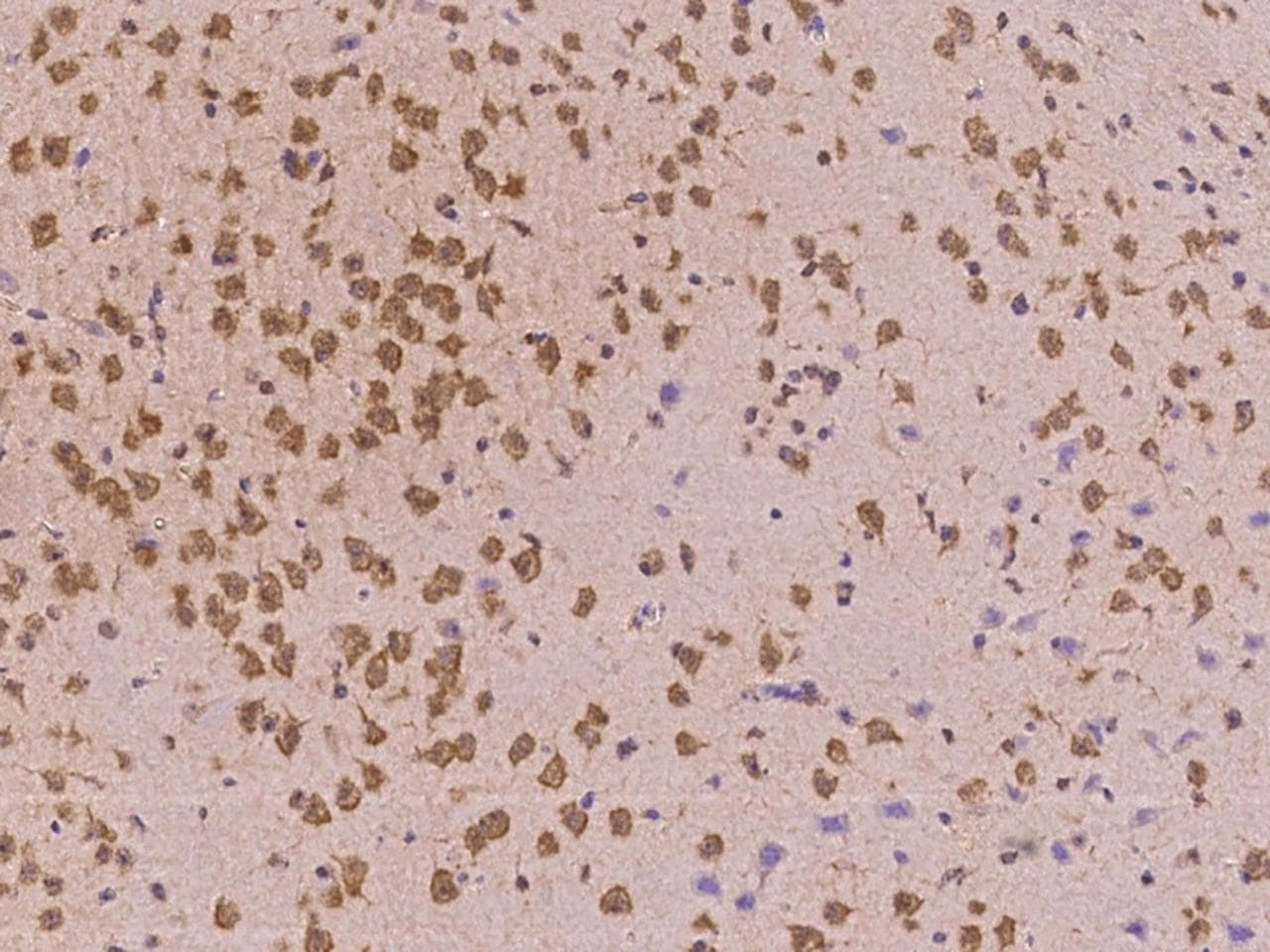 FGFR2 / FGF Receptor 2 Antibody (Preservative Free)