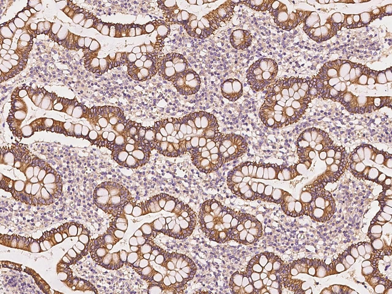 NAG20 / UBAP1 Antibody