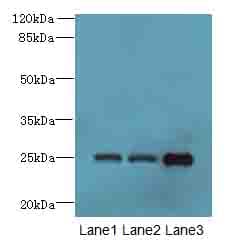 TMEM65 Antibody