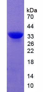 Rat CAPN1 / Calpain 1 Protein (Recombinant His, N-Terminal)