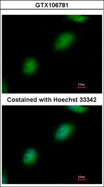 TPRKB Antibody (aa1-175)