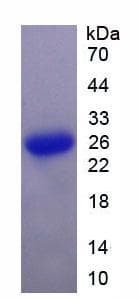 Mouse SOCS3 Protein (Recombinant His, N-Terminal)
