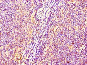 C17orf58 Antibody