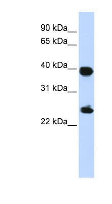 Polyclonal Rabbit anti-Human H2AFY / MACROH2A1 Antibody (aa144-193, IHC, WB)