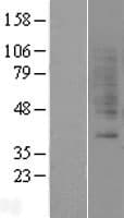 Human GRPR Protein (Over-Expression Lysate Myc-DDK (Flag))