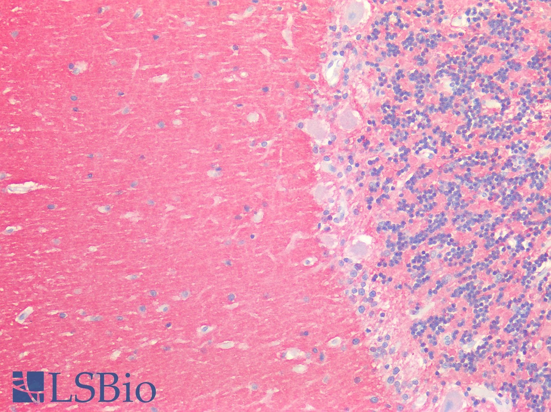 PathPlus™ Polyclonal Rabbit anti-Human SNAP25 Antibody (IHC, WB)