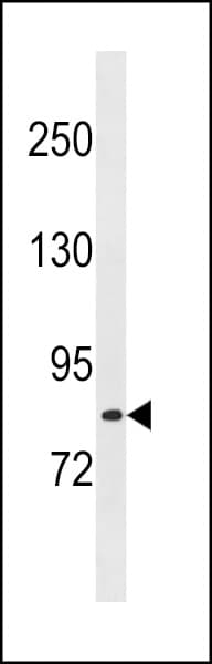 LRCH1 Antibody (aa304-333)