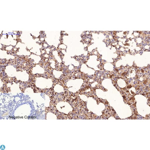 TUBE1 / Tubulin Epsilon Antibody