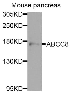 ABCC8 / SUR1 Antibody