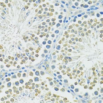 SLC1A4 / ASCT1 Antibody