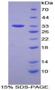Human FRA-1 / FOSL1 Protein (Recombinant His-T7)