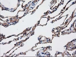 AQP1 / Aquaporin 1 Antibody (clone OTI2D10, Carrier-free)