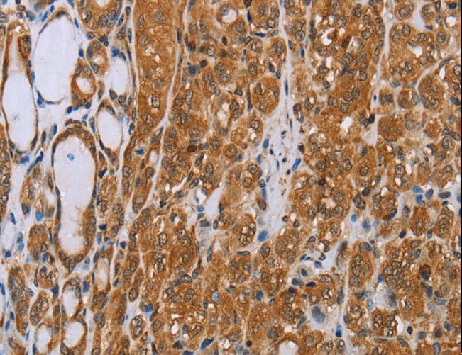 ADAMTS15 Antibody
