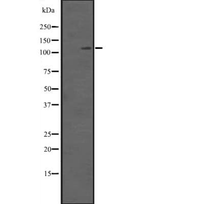 SETDB2 Antibody