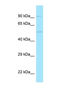 Polyclonal Rabbit anti-Human ADGRE5 / CD97 Antibody (aa397-446, WB)