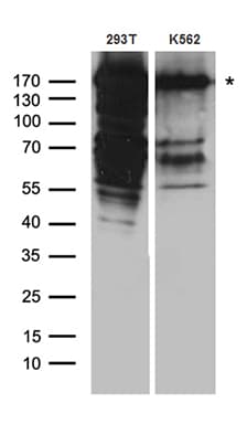 DSG1 / Desmoglein 1 Antibody