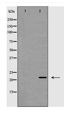 Polyclonal Rabbit anti-Human CLDN4 / Claudin 4 Antibody (IHC, WB)
