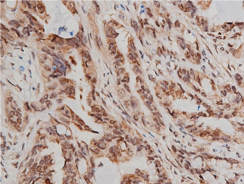 AKT1 Antibody (phospho-Ser473)
