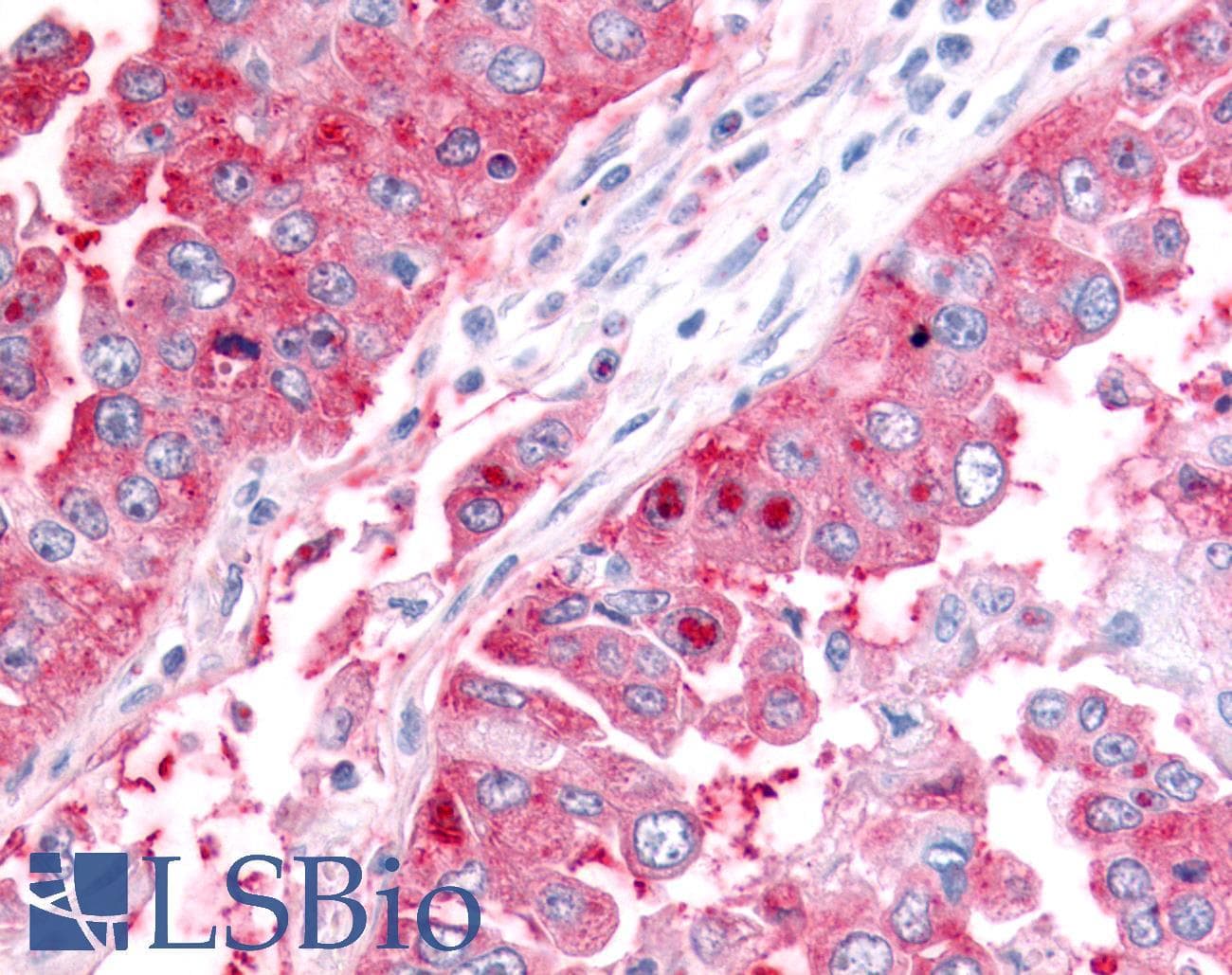 PathPlus™ Polyclonal Rabbit anti-Human ADAMTS5 Antibody (C-Terminus, IHC)