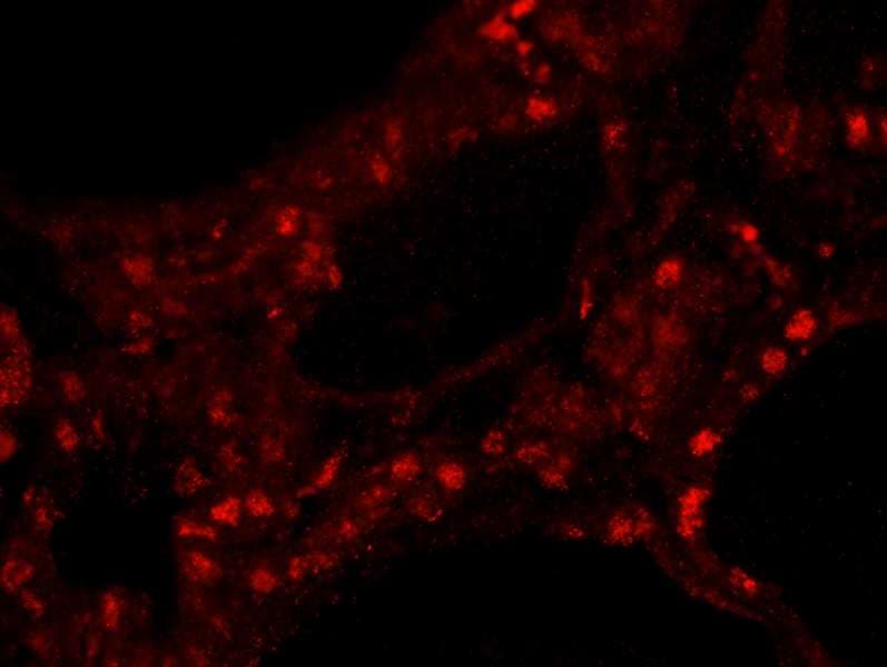 ZNF318 Antibody (aa2049-2099)