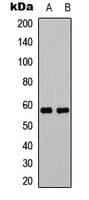 Polyclonal Rabbit anti-Human MLZE Antibody (Internal, WB)