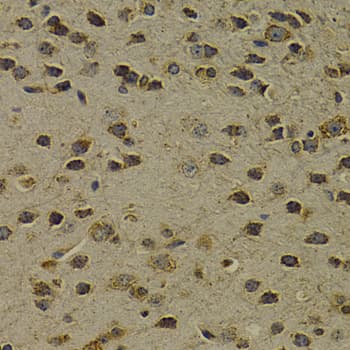 Polyclonal Rabbit anti-Human OGG1 Antibody (IHC, WB)