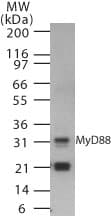 IHC-plus™ MYD88 Antibody (aa233-248)