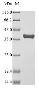 Mouse ANXA4 / Annexin IV Protein (Recombinant 10His, N-terminus + Myc, C-terminus)