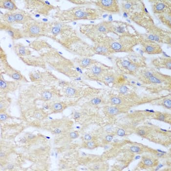 NUDT15 Antibody