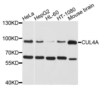 IHC-plus™ Polyclonal Rabbit anti-Human Cullin 4A / CUL4A Antibody (IHC, IF, WB)