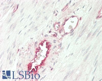 IHC-plus™ B2M / Beta 2 Microglobulin Antibody (aa 22-119)