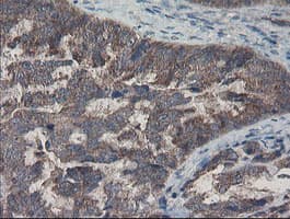 COMMD1 Antibody (clone OTI1G7)