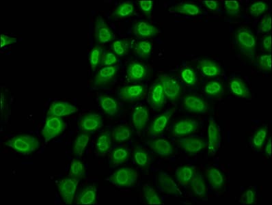 HIST1H2BN Antibody