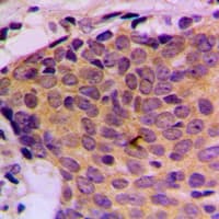 STAT5 A+B Antibody (C-Terminus)