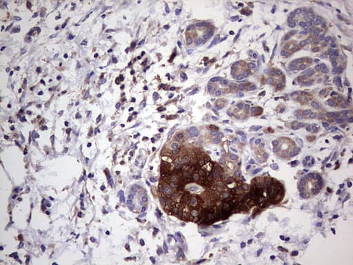 Monoclonal Mouse anti-Human PKM2 Antibody (clone 1F12, IHC, WB)