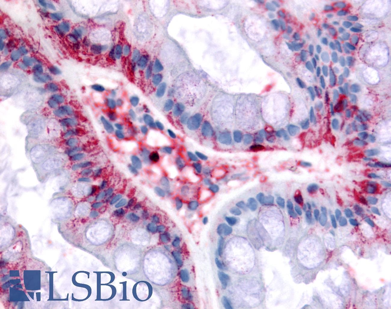 IHC-plus™ BEST4 Antibody (Internal)