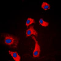 ADGRF5 / GPR116 Antibody (C-Terminus)