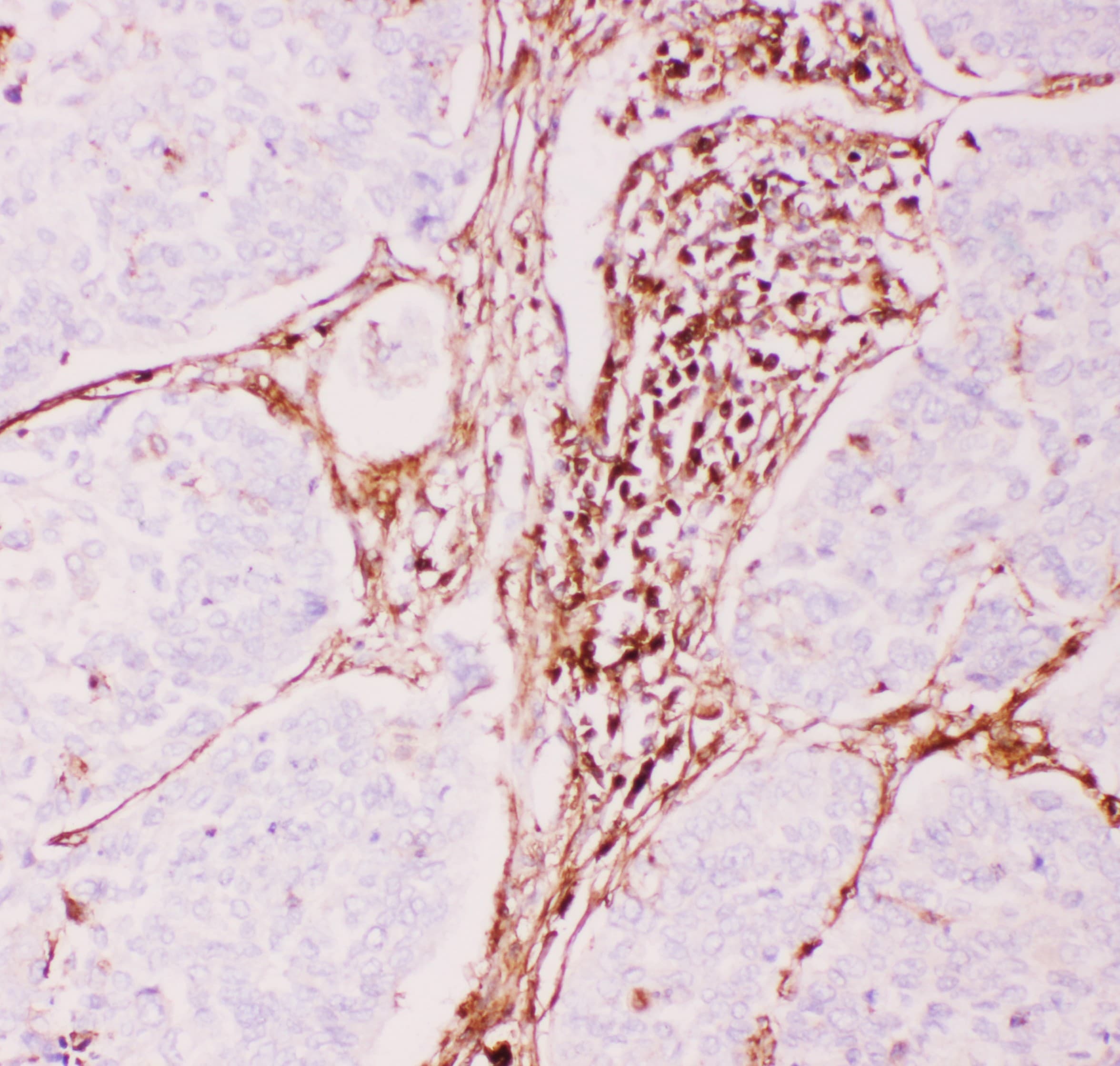 ABCB1 / MDR1 / P Glycoprotein Antibody (aa621-650)