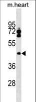 LPXN / Leupaxin Antibody (aa229-257)