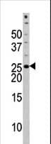 Polyclonal Rabbit anti-Human BAD Antibody (phospho-Ser118, IHC, WB)