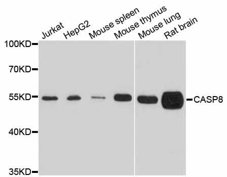 CASP8 / Caspase 8 Antibody