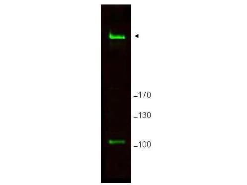 IHC-plus™ RIF1 Antibody (aa2375-aa2419)