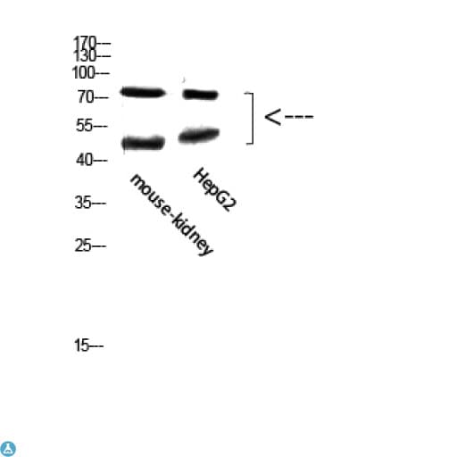 Polyclonal Rabbit anti-Human TMPO / TP / Thymopoietin Antibody (IF, WB)