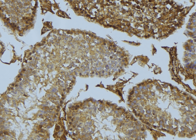 Polyclonal Rabbit anti-Human RGS1 Antibody (IHC, WB)