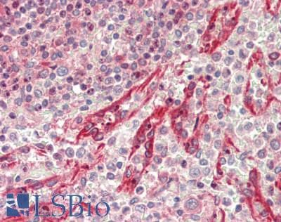 IHC-plus™ EEA1 Antibody (aa175-225)