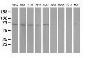 PUS7 Antibody (clone OTI4A2)