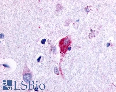 PathPlus™ Polyclonal Rabbit anti-Human ADGRF4 / GPR115 Antibody (C-Terminus, IHC)