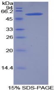 Rat KLK6 / Kallikrein 6 Protein (Recombinant GST-His, N-terminus)