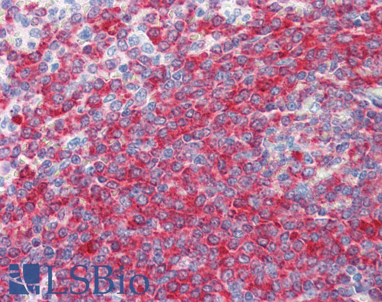 PathPlus™ PDCD4 Antibody (aa1-469, clone K4C1)